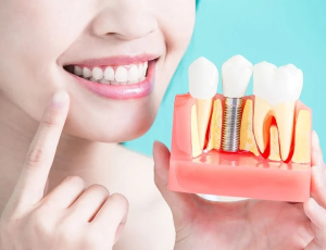 Dental Implant Clinic
