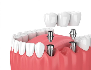 Periodontist